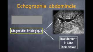 Pancréatite aiguë  1 Diagnostic positif [upl. by Jezreel]