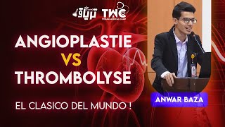 CARDIOLOGIE  Angioplastie VS Thrombolyse  Anwar Baza [upl. by Mauretta61]