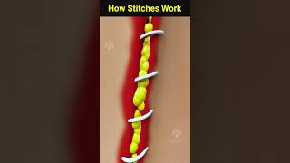 How wound stitches really work shorts facts  Creativelearning3d [upl. by Leatri]