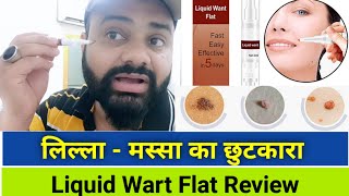 Liquid wart flat how to use  wart remover  Self review [upl. by Virendra858]