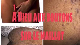 Stop aux boutons sur le maillot [upl. by Hanoj]