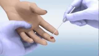 DPP® HIV 12 Assay  Whole Blood Sample [upl. by Evad]