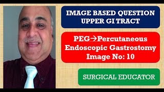 PERCUTANEOUS ENDOSCOPIC GASTROSTOMY UPPER GI TRACT Image Based Question [upl. by Osrock962]