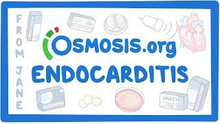 Clinicians Corner Endocarditis [upl. by Lehpar]