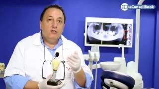 Clinique Dentaire Internationale Casablanca § Dr Jalil BERRADA Implants dentaires [upl. by Pretrice515]