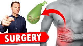 Gallbladder Surgery Removal WATCH THIS [upl. by Ilagam]