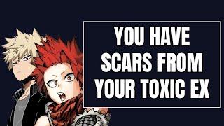 You have scars from your toxic ex  Kiribaku x listener [upl. by Uta]