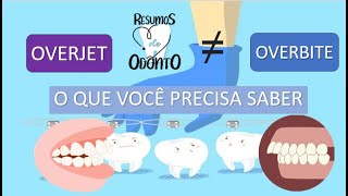 Overbite e Overjet  Resumos de Odonto [upl. by Raseac983]