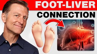 The Shocking Link Between Your Liver and Your Feet 12 Things Your Feet Can Tell You [upl. by Monia]