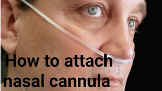 Nasal cannula oxygen therapy [upl. by Caffrey]