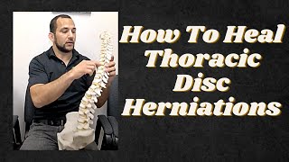 Thoracic Spine Disc Herniations [upl. by Aneev]