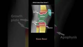 Bone Anatomy knee example 1 Musculoskeletal Xray  General principles radiologychannel007 [upl. by Xerxes]