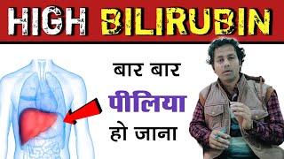 क्या उच्च बिलीरुबिन ठीक हो सकता है  HIgh Bilirubin  High sgpt  sgot  dr tarun [upl. by Prowel28]