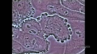 Mitosis in an animal cell Under the Microscope [upl. by Enyaw891]