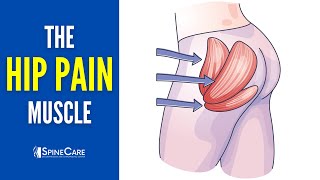 The Hip Pain Muscle How to Release It for INSTANT RELIEF [upl. by Airyt429]