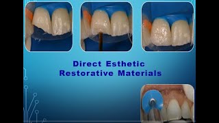 Direct Esthetic Restorative Materials Composite What does it mean [upl. by Ahsimin]