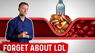 Forget LDL – Focus on Remnant Cholesterol – Dr Berg [upl. by Eidnil497]