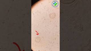 Parasitology  H Nana  hymenolepis nana under microscope  Tapeworm stool examination  H Nana ova [upl. by Jar]