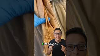 Nervo Ciático 😮🦵 curiosidades enfermagem medicina medico saude enfermeira anatomia ciatico [upl. by Farwell]