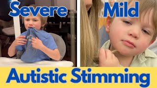 12 Examples of Autism Stimming [upl. by Bonn]