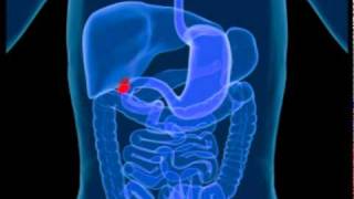 Gallbladder Disease  A Brief Look At Gallbladder Disease [upl. by Notlad]