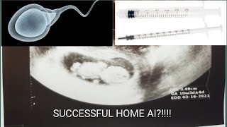 AI TAGALOGSUCCESSFUL HOME ARTIFICIAL INSEMINATION PHILIPPINES DUTCH DONOR FREE SPERM DONATION [upl. by Llesirg]