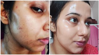 My Honest Morning Skincare Routine to remove Dark spots Pimple Marks Acne ScarsHyperpigmentation [upl. by Horten]