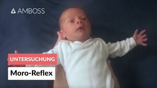 MoroReflex  Frühkindliche Reflexe  AMBOSS Video [upl. by Diann271]