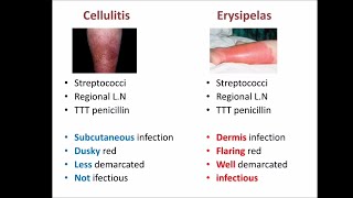 cellulitis vs erysipelas [upl. by Imoyik]