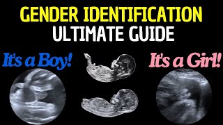 How to Determine Babys Gender with Ultrasound Complete Guide ultrasound babygenderprediction [upl. by Alamaj]