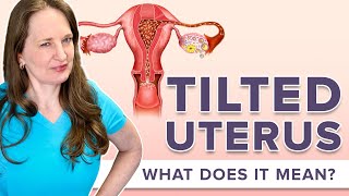 Is It Harder To Conceive With Retroverted Uterus  Dr Lora Shahine [upl. by Enitsed233]