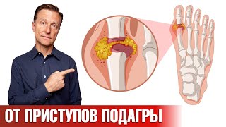 Средство №1 от приступов подагры которое есть у каждого👍 [upl. by Pelpel]