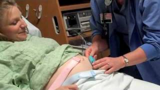 Maternity Fetal Monitoring [upl. by Eilasor523]