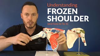 Understanding FROZEN SHOULDER and how to stretch for greater movement [upl. by Hamrah]