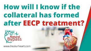 EECP Therapy Episode 1 Decoding Angina  Can EECP be our Hearts Ally [upl. by Aitan]