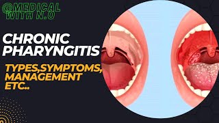 chronic pharyngitis types PATHOPHYSIOLOGY TREATMENT  DIAGNOSIS etc pharyngitis medical [upl. by Alehtse]