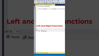 SQL Very Useful Left and Right Functions datascience programming coding [upl. by Yunfei]