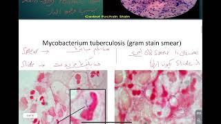 Microbiology practical Mycobacterium [upl. by Pliske458]