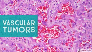 Vascular Tumors of the Skin  Explained by a Soft Tissue Pathologist [upl. by Lotsyrc]