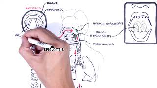 Stridor in children causes inspiratory and expiratory stridor pathophysiology [upl. by Agni]