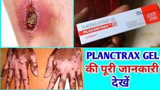 PLACENTREX GEL की पूरी जानकारी देखें फ़ायदे और नुकसान जानें  PLACENTREX GEL USES IN HINDI [upl. by Adnerad]