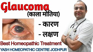 Glaucoma गलूकोमा।काला मोतिया  cause symptoms and homeopathic treatment without surgery [upl. by Vevine]