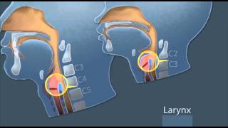 GlideScope Pediatric Airway Rounds Small Anatomies [upl. by Wilmette]