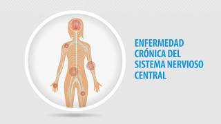 ¿Qué es la fibromialgia [upl. by Salb48]