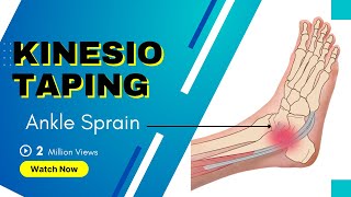 How to treat an Ankle Inversion Sprain  Kinesiology Taping to stabilise ligaments [upl. by Olinde392]