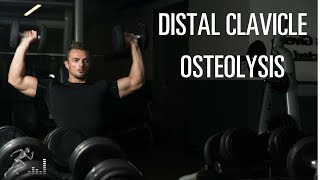 Distal clavicle osteolysis A common shoulder injury for weightlifters and many workers [upl. by Edme]