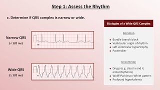 Intro to EKG Interpretation  A Systematic Approach [upl. by Sibie]