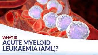 Classification of Acute Myeloid leukemia according to World health Organization [upl. by Durwyn850]