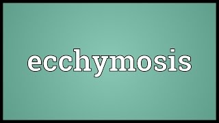 Ecchymosis Meaning [upl. by Roswell]