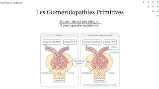 les Glomérulopathies Primitives  LGM HSF GEM maladie de BERGER GNMP GNRP nephro [upl. by Atnamas607]